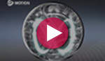 Six Motion